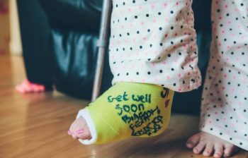 close up of foot in cast with toes sticking out